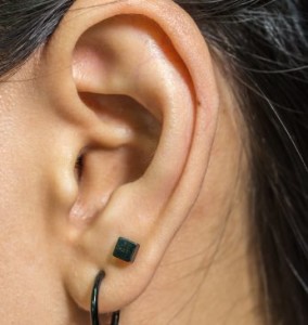 Ear lobe correction